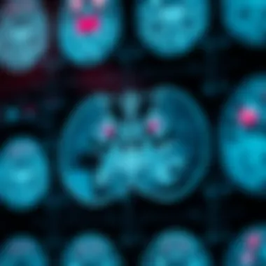 Brain scans showing cognitive decline